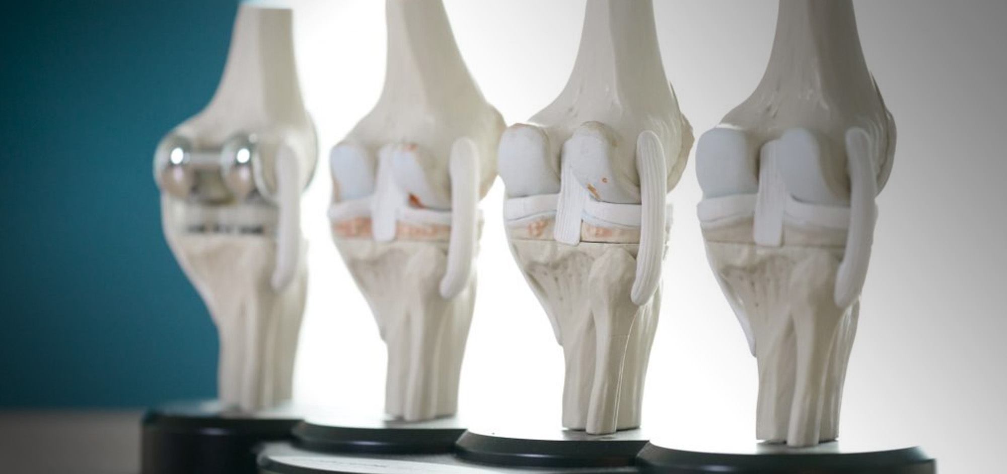 Adelaide Hip & Knee Centre The future of hip and knee surgery is here.